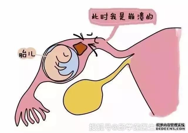 金华妇科:以为宫外孕只是小事?太天真!