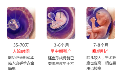 金华敖汉旗三个月能做无痛人流吗 金华敖汉旗三个月能做无痛人流吗